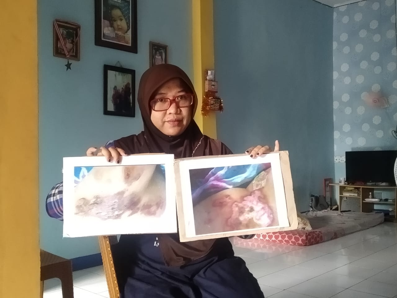 Ira, pasien yang diduga korban mall praktek